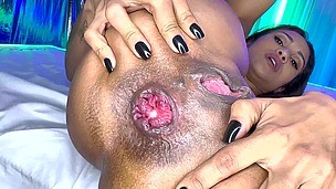 flexi milf prolapse her destroyed anus - AnalVids screenshot